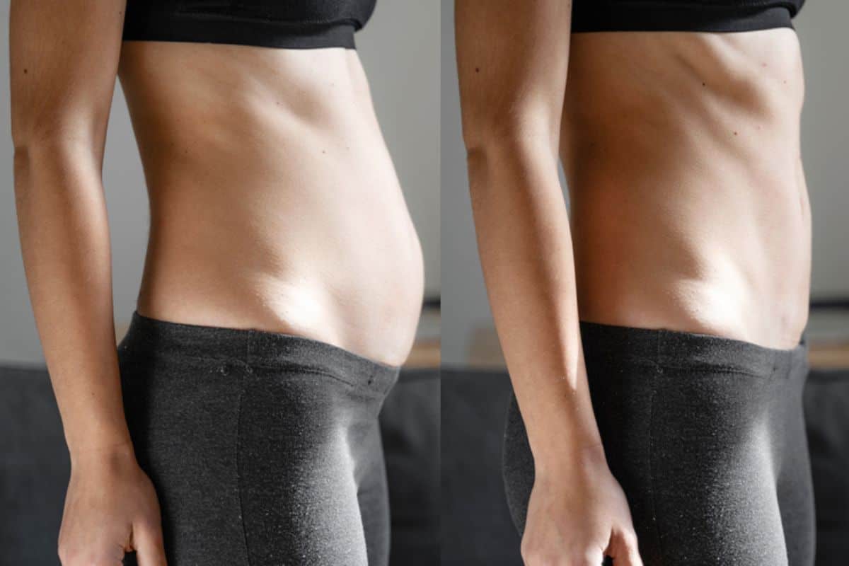 Post-Pregnancy: What Happens to Your Abdominal Muscles After Birth East Sussex