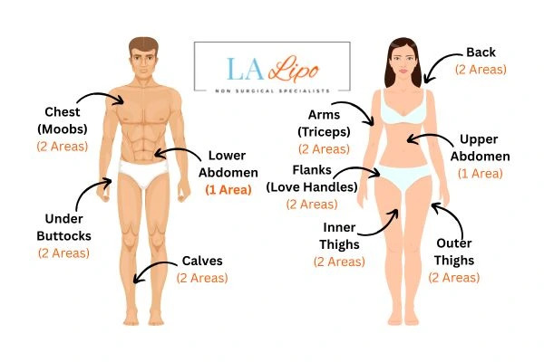 LA LIPO Cryolipolysis Areas East Sussex