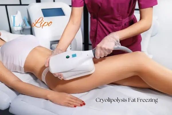 Woman receiving coolsculpting East Sussex treatment on her thighs