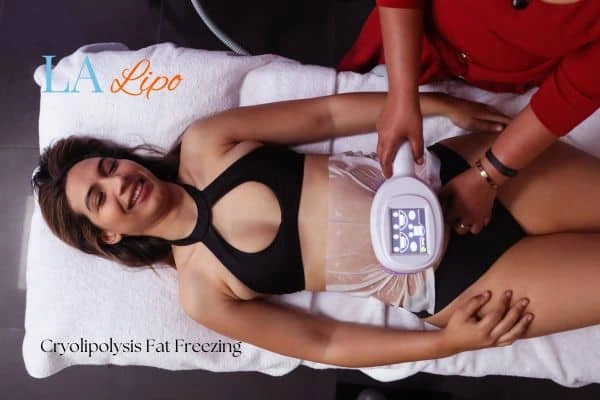 woman getting cryolipolysis East Sussex