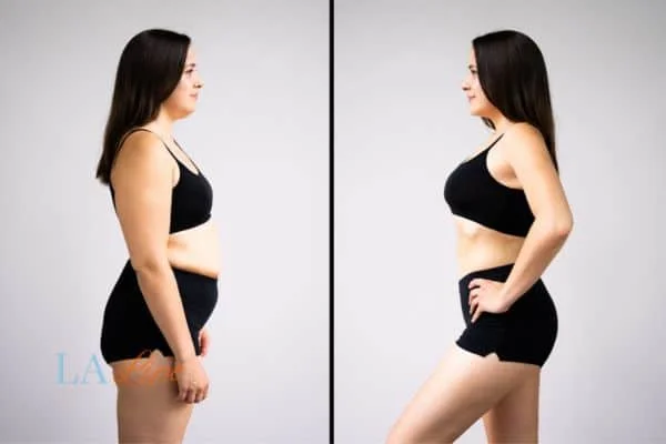 link between body image and mental health East Sussex
