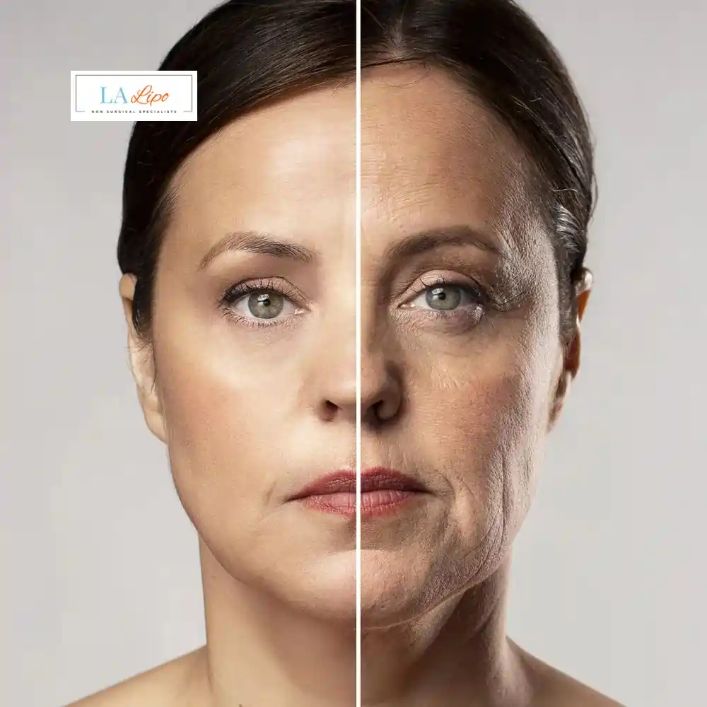 How Can You Tell If Non-Surgical Skin Tightening Is Right for You East Sussex?