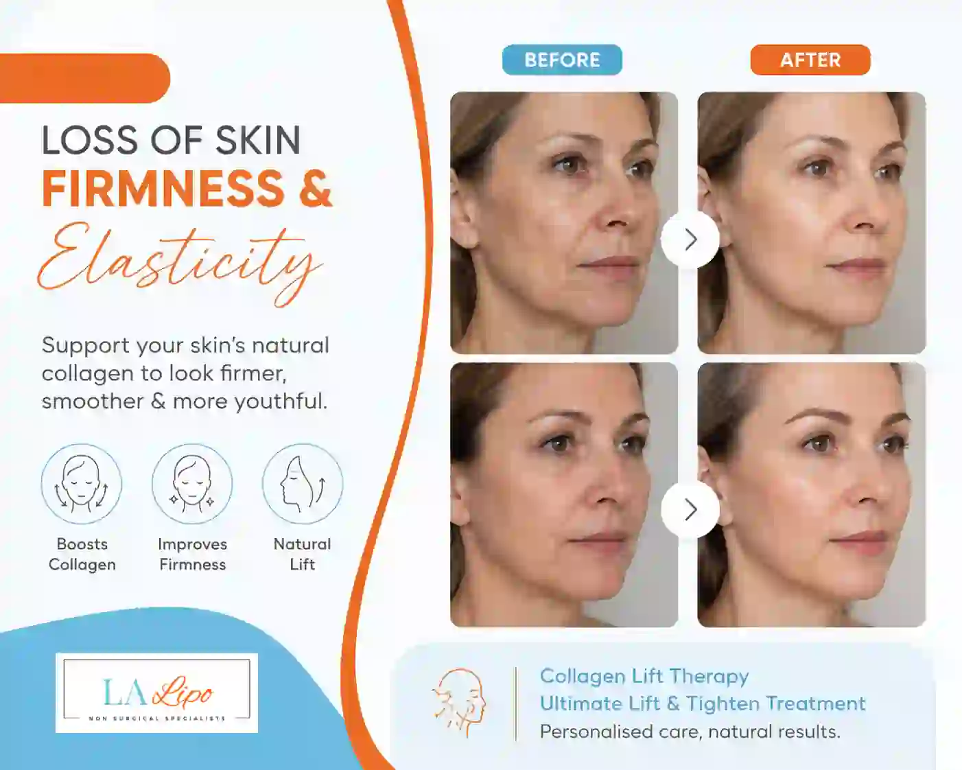 Sign #7: Loss of Skin Firmness and Elasticity East Sussex