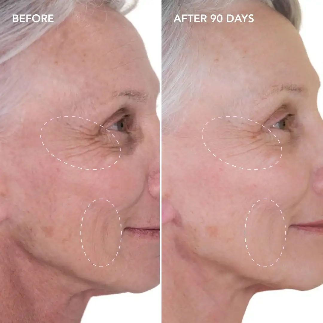 When will you see results East Sussex
